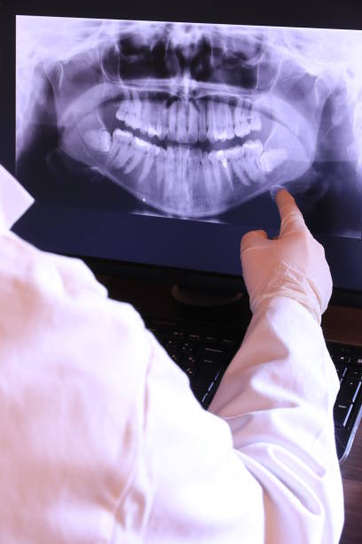 Best Emergency Wisdom Teeth Removal in Piednt, MO